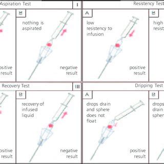 verse needle drop test|veres needle pressure chart.